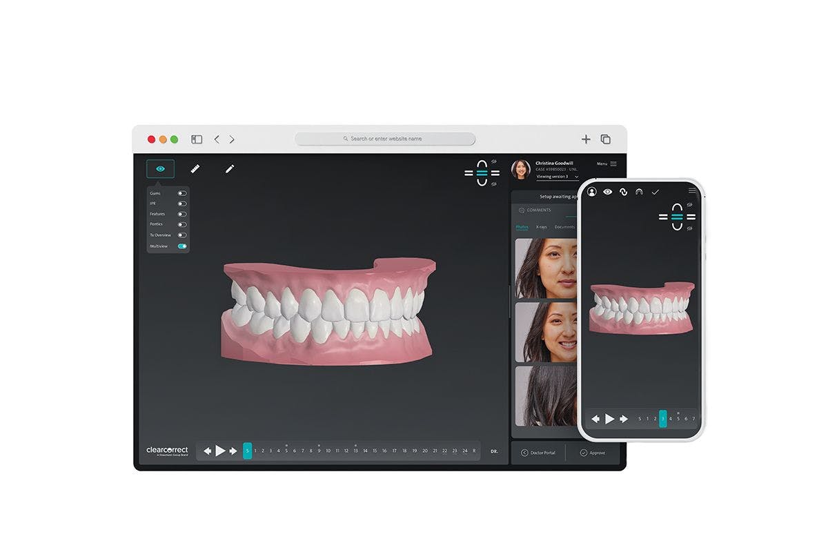 New Suite of Products from ClearCorrect Designed to Elevate Orthodontic Offerings | Image Credit: © ClearCorrect